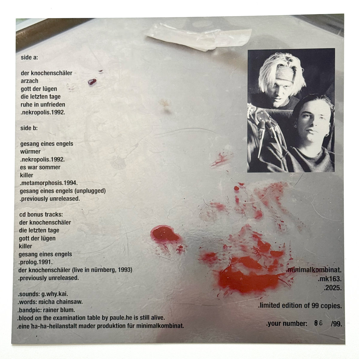 Les Berrtas (1992-1994) (Vinyl)